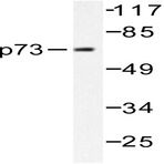 p73 (V93) pAb