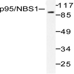 Nibrin (T337) pAb