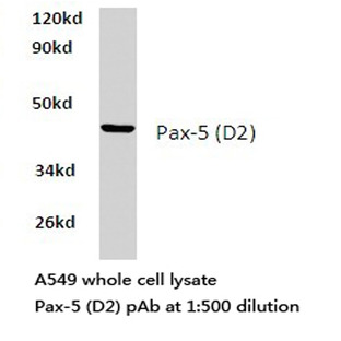 Pax-5 (D2) pAb