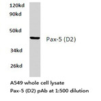 Pax-5 (D2) pAb