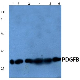 PDGF-B (L48) pAb