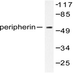 PRPH (S454) pAb