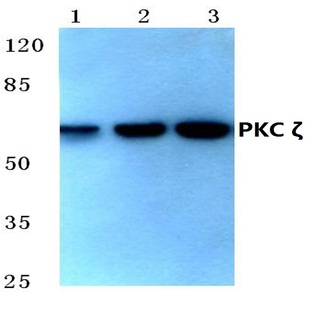 PKC (zeta)(P404) pAb