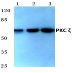 PKC (zeta)(P404) pAb