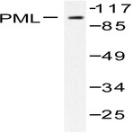 PML (P39) pAb