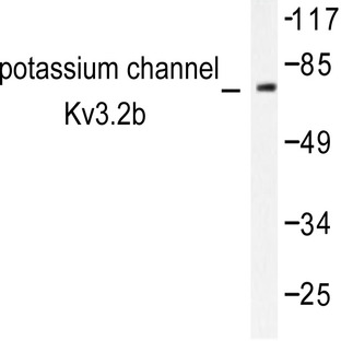 Kv3.2 (P626) pAb