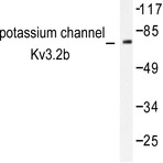 Kv3.2 (P626) pAb