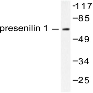 PSEN1/ PS-1 (S28) pAb