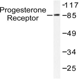 PR (V184) pAb