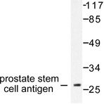 PSCA (V71) pAb