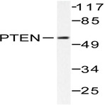 PTEN (D375) pAb