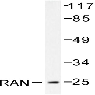 RAN (E202) pAb