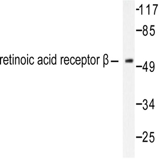 RAR(beta) (L359) pAb