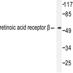 RAR(beta) (L359) pAb