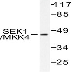 MEK-4/ MAP2K4 (E74) pAb
