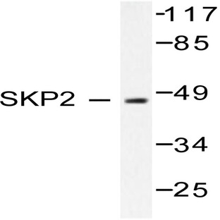 Skp2 p45 (P399) pAb