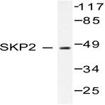 Skp2 p45 (P399) pAb