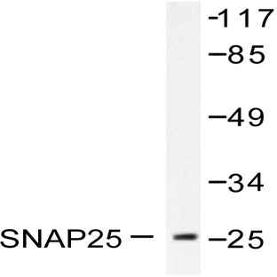 SNAP 25 (E183) pAb