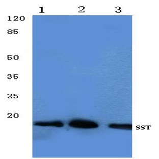 Somatostatin (V22) pAb