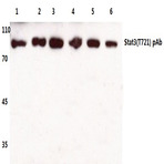 Stat3 (T721) pAb