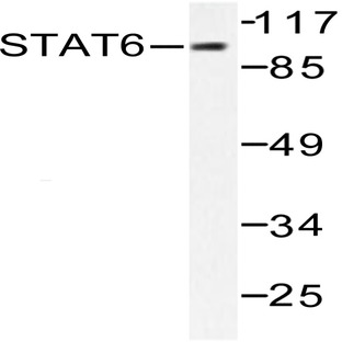 Stat6 (G635) pAb