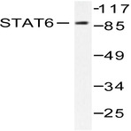 Stat6 (R639) pAb