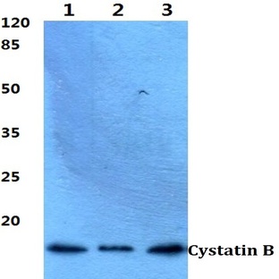 Cystatin B (N84) pAb