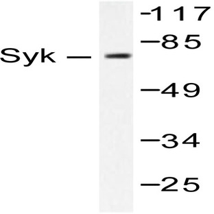 Syk (F169) pAb