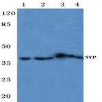 Synaptophysin (L128) pAb