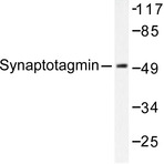 Synaptotagmin (M303) pAb