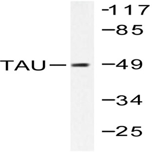 Tau (T175) pAb