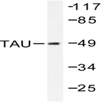 Tau (T175) pAb