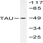 Tau (S199) pAb