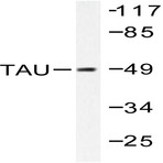 Tau (S208) pAb