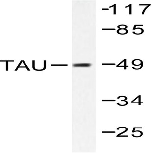 Tau (K225) pAb