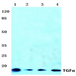 TGF(alpha) (R139) pAb