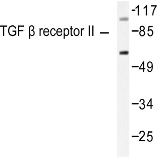 TGF(beta) RII (I122) pAb