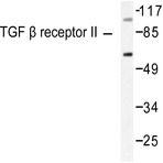 TGF(beta) RII (I122) pAb