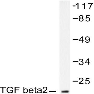 TGF(beta)2 (L388) pAb