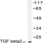 TGF(beta)2 (L388) pAb