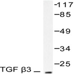 TGF (beta)3 (G292) pAb