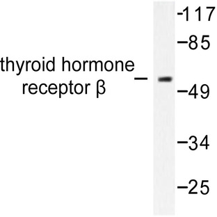 THRB (L37) pAb
