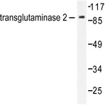 TGase2 (D11) pAb