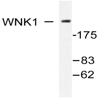 WNK1 (Y52) pAb