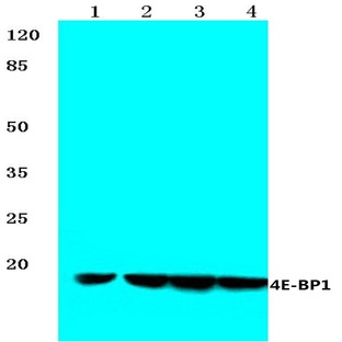 4E-BP1 (N63) pAb