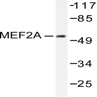 MEF-2 (I402) pAb