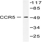 CCR5 (T343) pAb