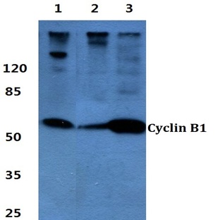 Cyclin B1 (I120) pAb