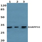 DARPP-32 (P69) pAb