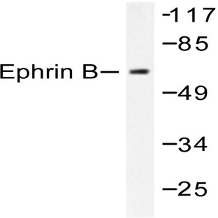 Ephrin-B1/2 (Q324) pAb